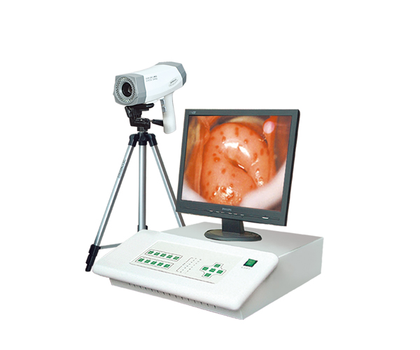 Digital electronic colposcopy